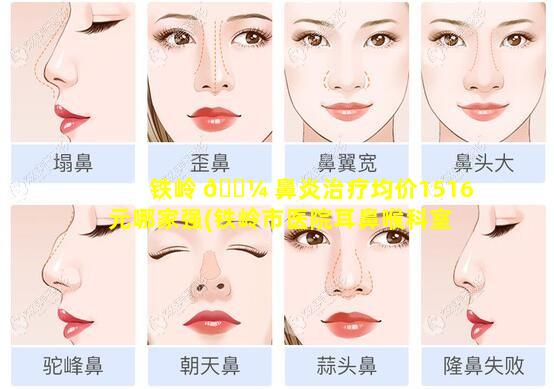 铁岭 🌼 鼻炎治疗均价1516元哪家强(铁岭市医院耳鼻喉科室大夫)